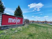 Meijer sign